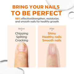 Modelones-uñas-dañadas-reparacion: muestra reparación suave para uñas dañadas.