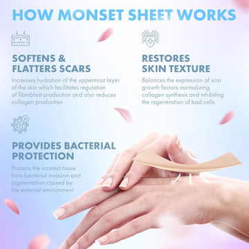 MONSET silicona para estrias, uso diario para reducción gradual.