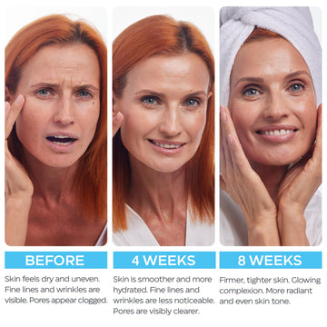 MOONRIN COSMETICS imagen destacando firmeza suave de la piel