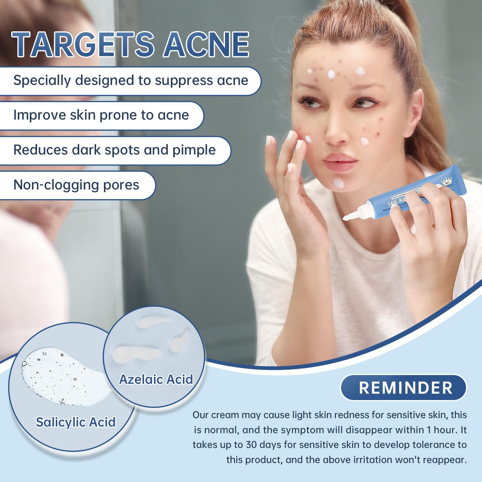 Mopayzer azelaic acid cream texture close-up shows a light, fast-absorbing formula