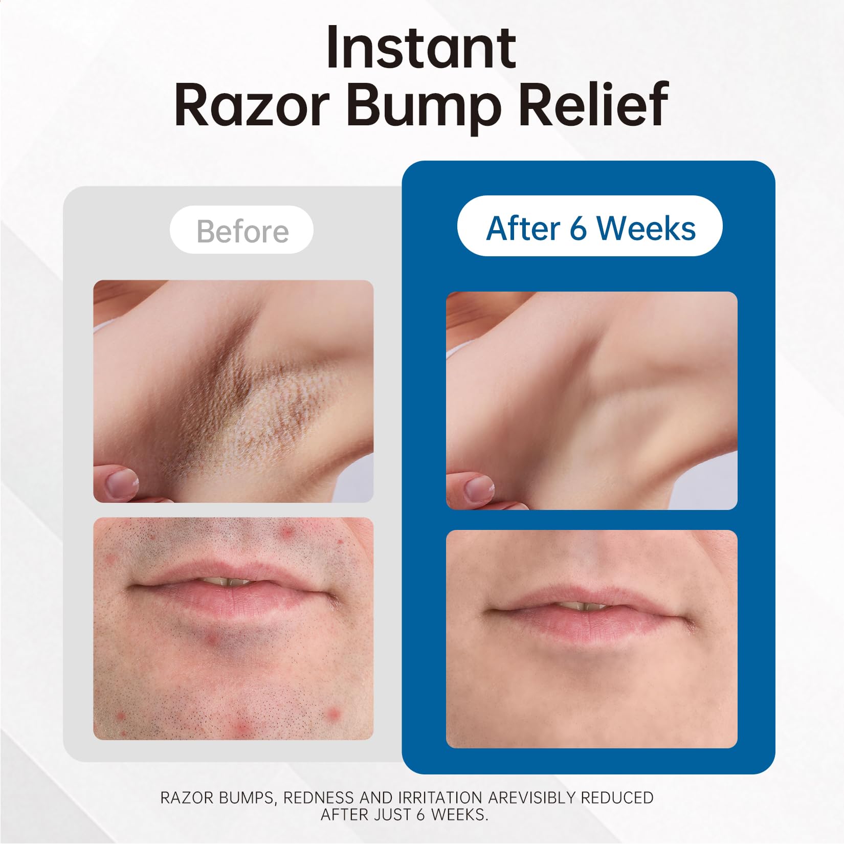 Morovan serum de absorcion rapida para piel limpia y suave.