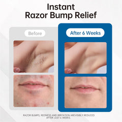 Morovan serum de absorcion rapida para piel limpia y suave.