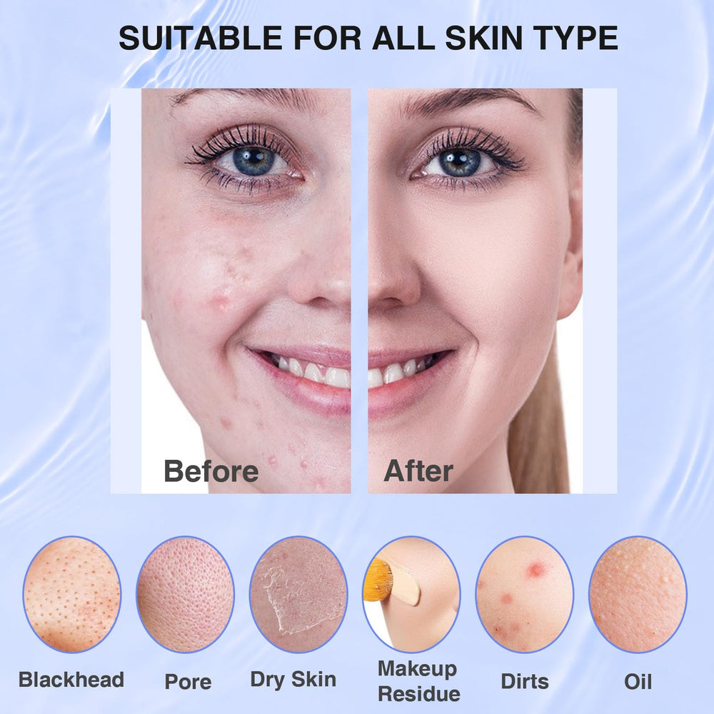 Mosnami limpieza diaria de la piel con cabezal suave para exfoliación suave.