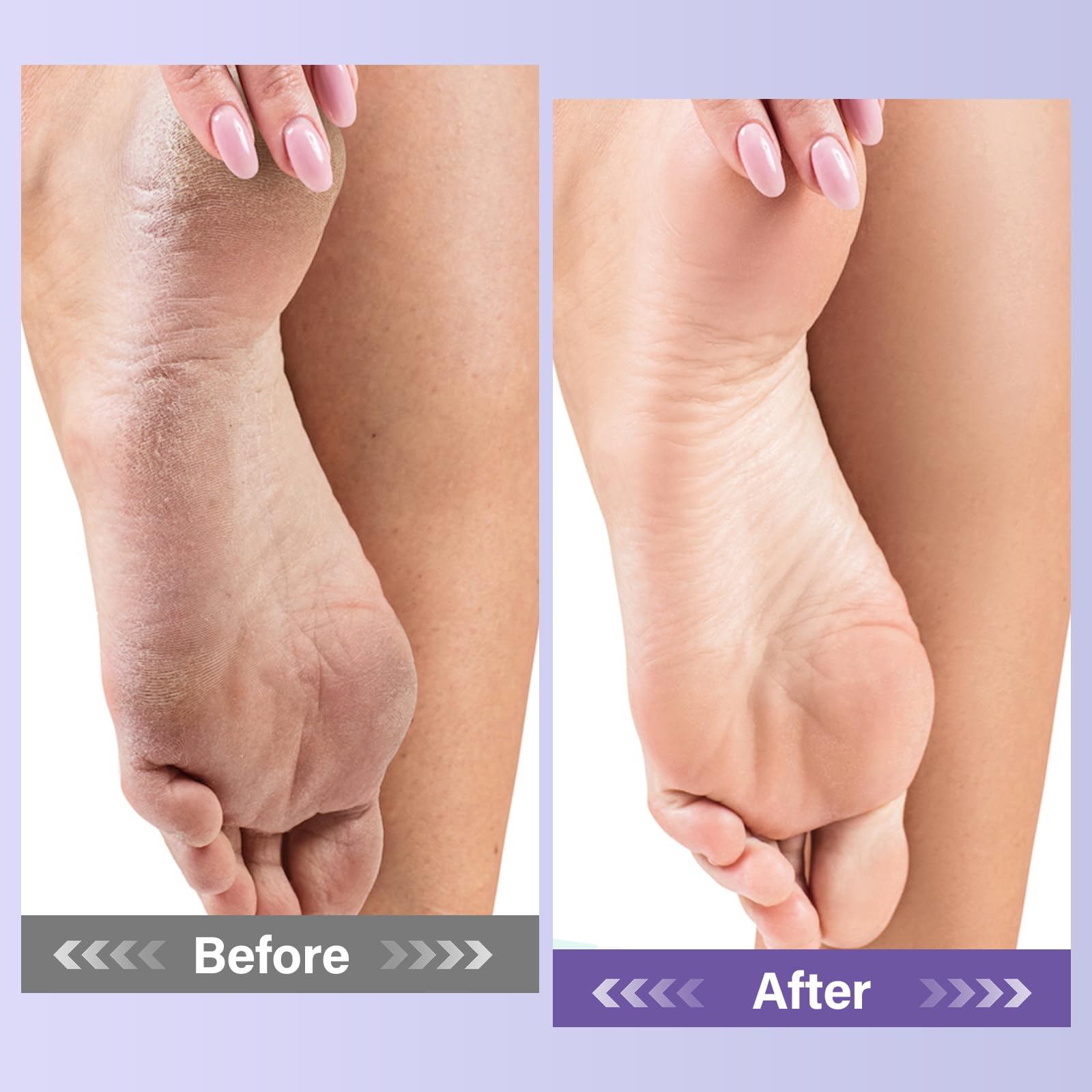 MOSRROU gel exfoliante lavanda para pies, acompaña la hidratación.
