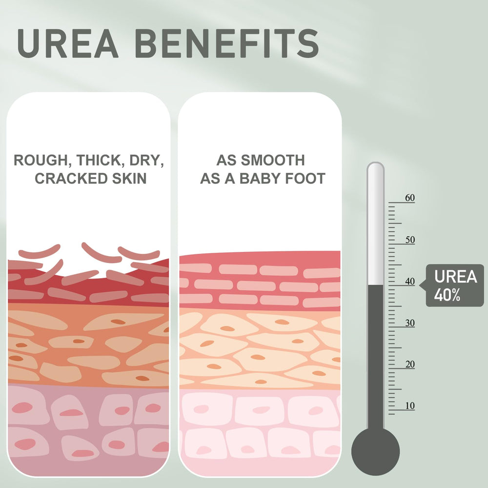 Mouriven Urea 40% para pies, hidrata y suaviza