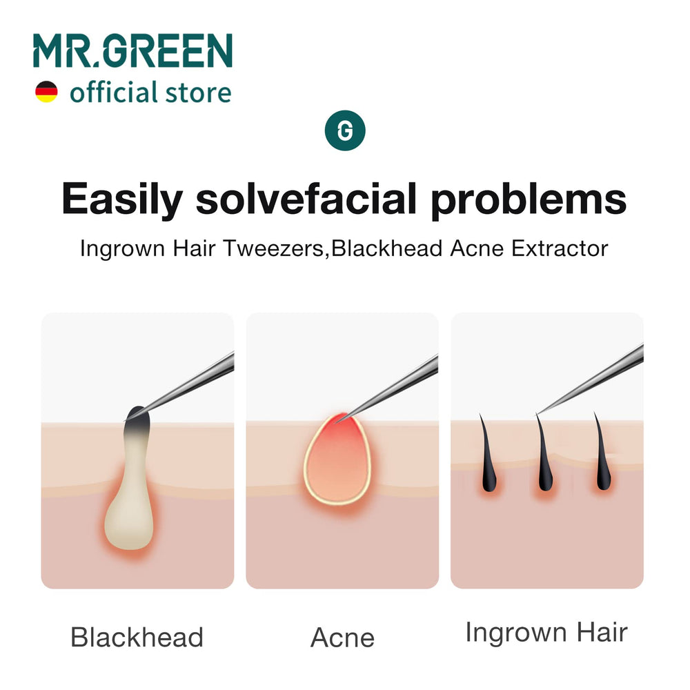MR.GREEN pinzas para extracción de astillas con precisión