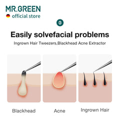 MR.GREEN pinzas para extracción de astillas con precisión