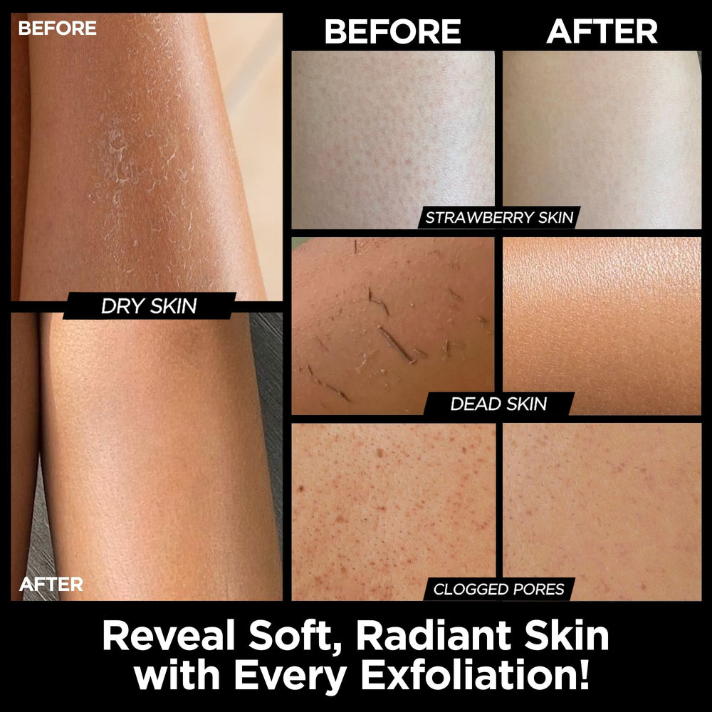 MS Guante Kessa exfoliante: textura suave para piel sensible.