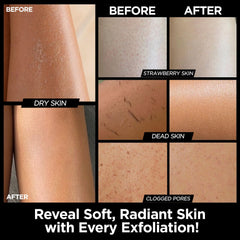 MS Guante Kessa exfoliante: textura suave para piel sensible.