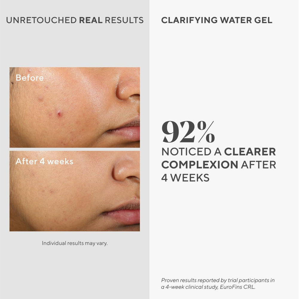 Murad Gel Clarificante, textura ligera: aplicación refrescante para uso diario