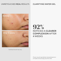 Murad Gel Clarificante, textura ligera: aplicación refrescante para uso diario