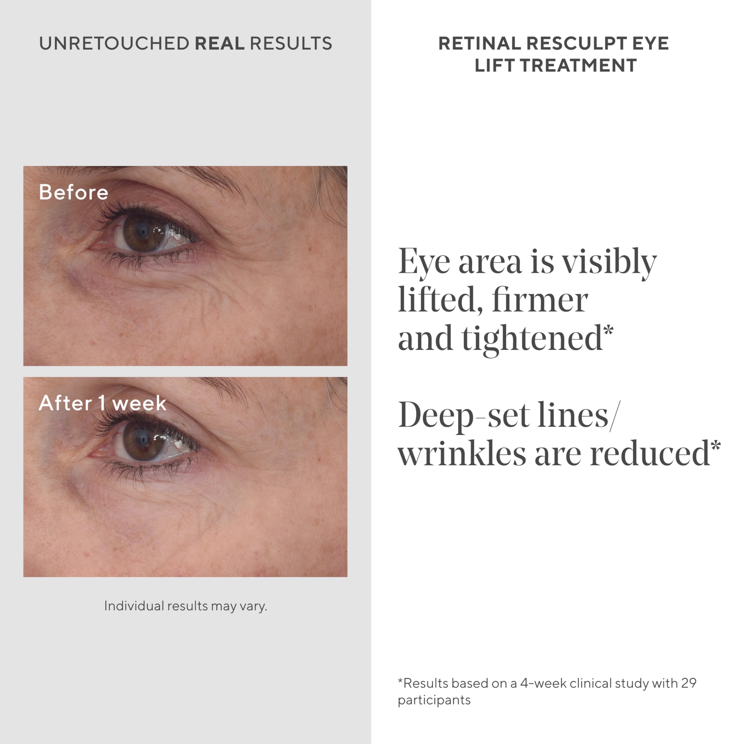 Murad Retinal ReSculpt: bolsas bajo los ojos reducidas con efecto tensor