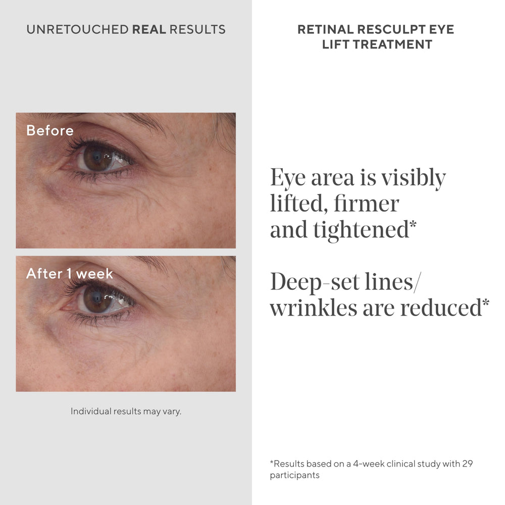 Murad Retinal ReSculpt: bolsas bajo los ojos reducidas con efecto tensor