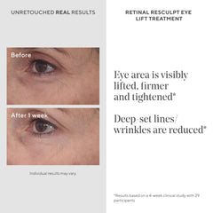 Murad Retinal ReSculpt: bolsas bajo los ojos reducidas con efecto tensor