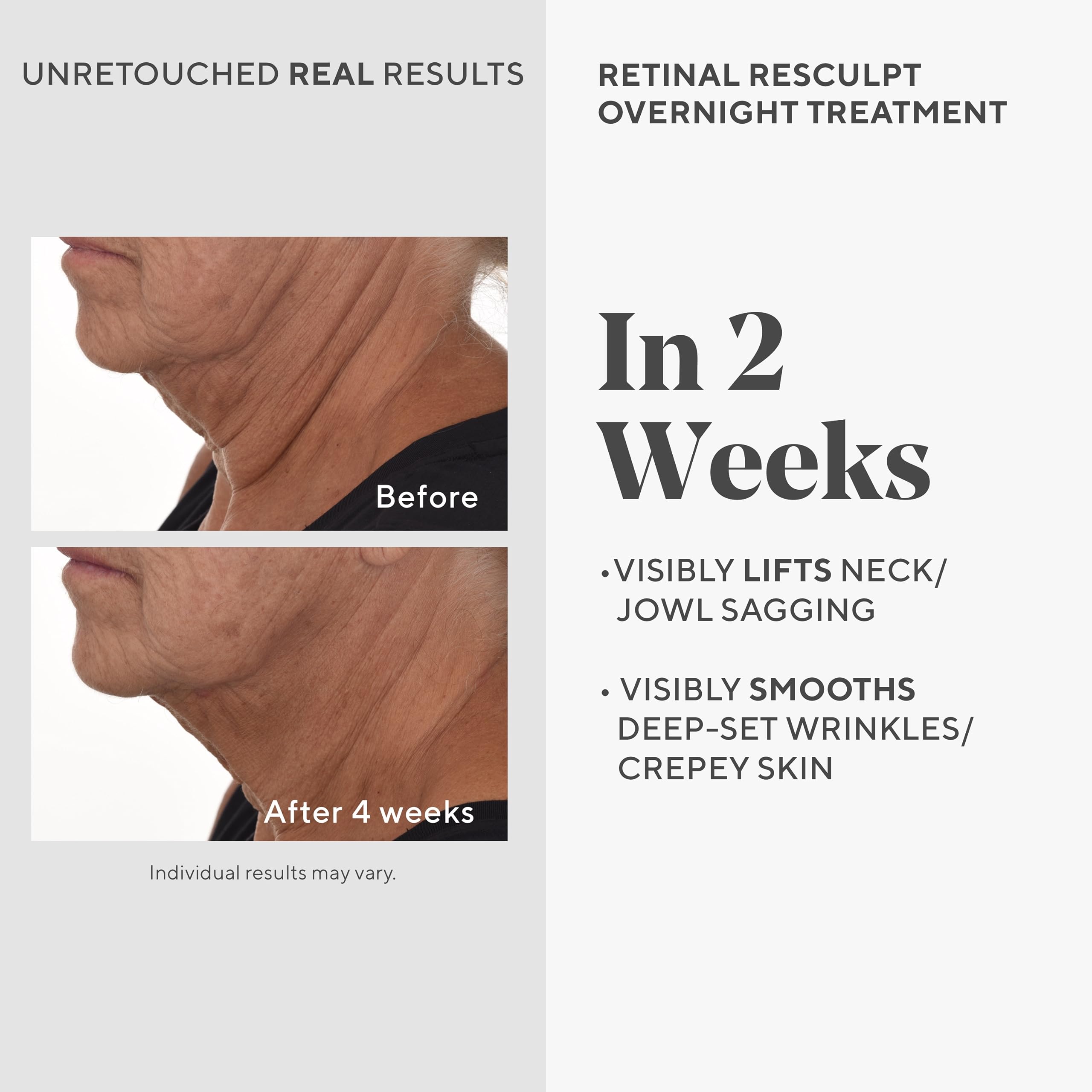 Murad Retinal ReSculpt: textura sedosa del serum para rostro y cuello.