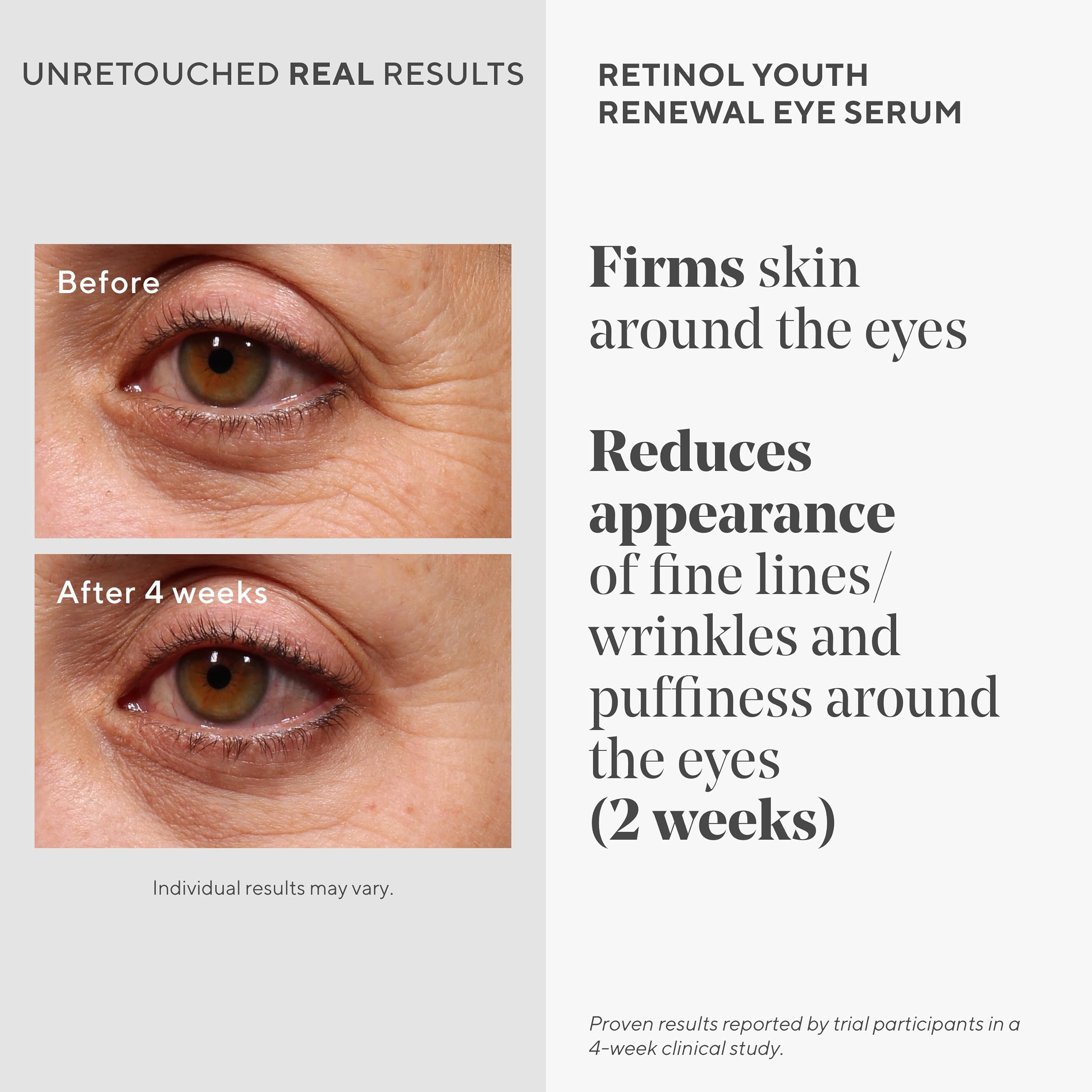 Murad serum ocular con retinol, textura suave para piel sensible.