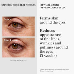 Murad serum ocular con retinol, textura suave para piel sensible.