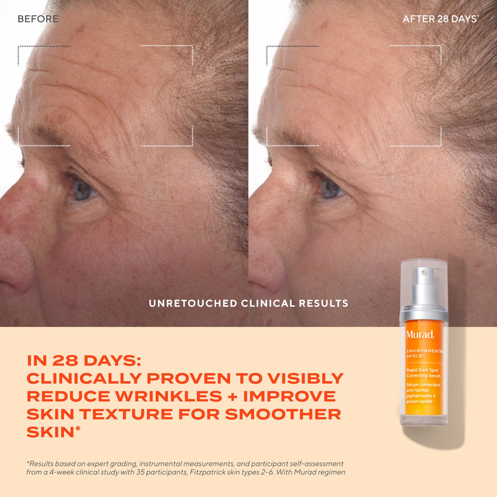 Application visage matin avec Murad Rapid Dark Spot Serum pour un teint clair.