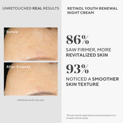 Murad tecnología retinol tri-activo, muestra firmeza gradual.