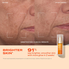 Fórmula sin parabenos de Murad Vita-C Glycolic Serum