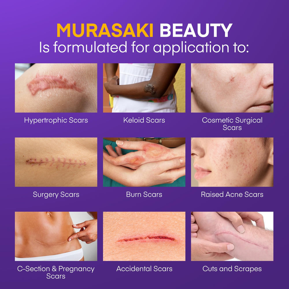 MURASAKI BEAUTY aplicación diaria de gel silicona para cicatriz facilita tratamiento.