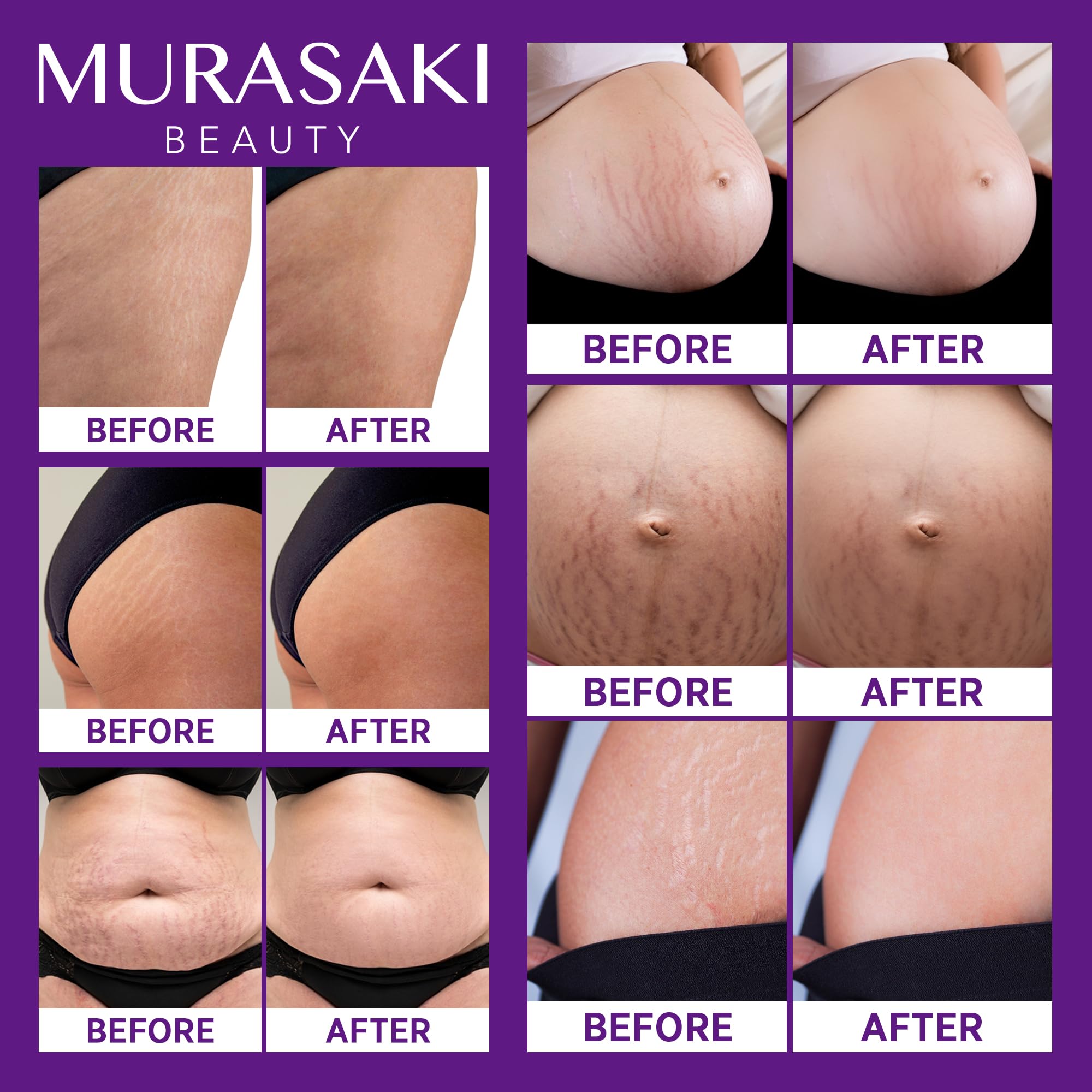 Textura no grasa de MURASAKI BEAUTY crema para embarazo se absorbe rápido.