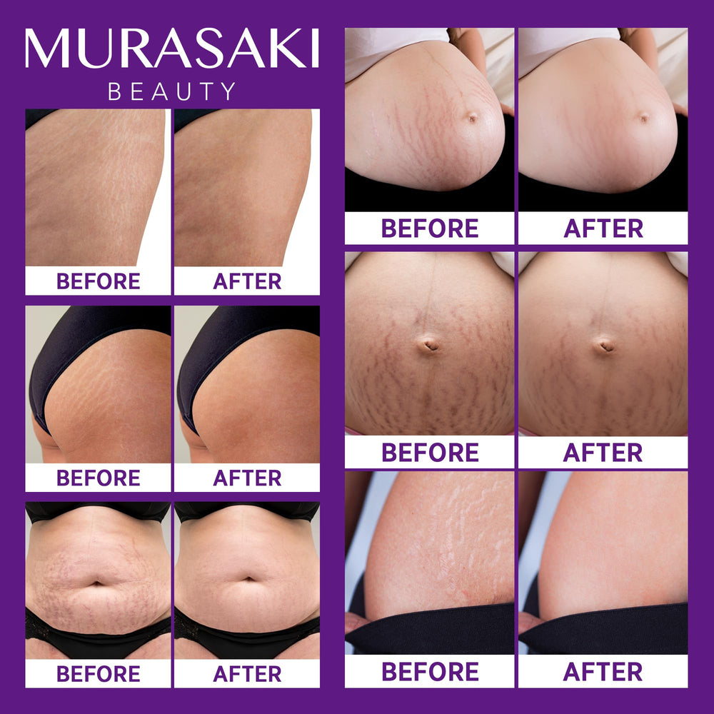 Textura no grasa de MURASAKI BEAUTY crema para embarazo se absorbe rápido.