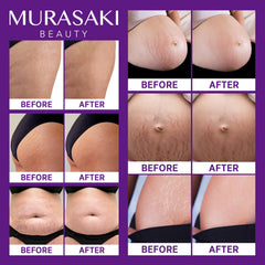 Textura no grasa de MURASAKI BEAUTY crema para embarazo se absorbe rápido.