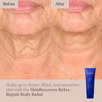 Nakery SkinRecovery: dormir mejor gracias a melatonina y aroma suave.
