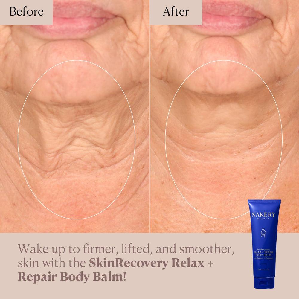 Nakery SkinRecovery: dormir mejor gracias a melatonina y aroma suave.