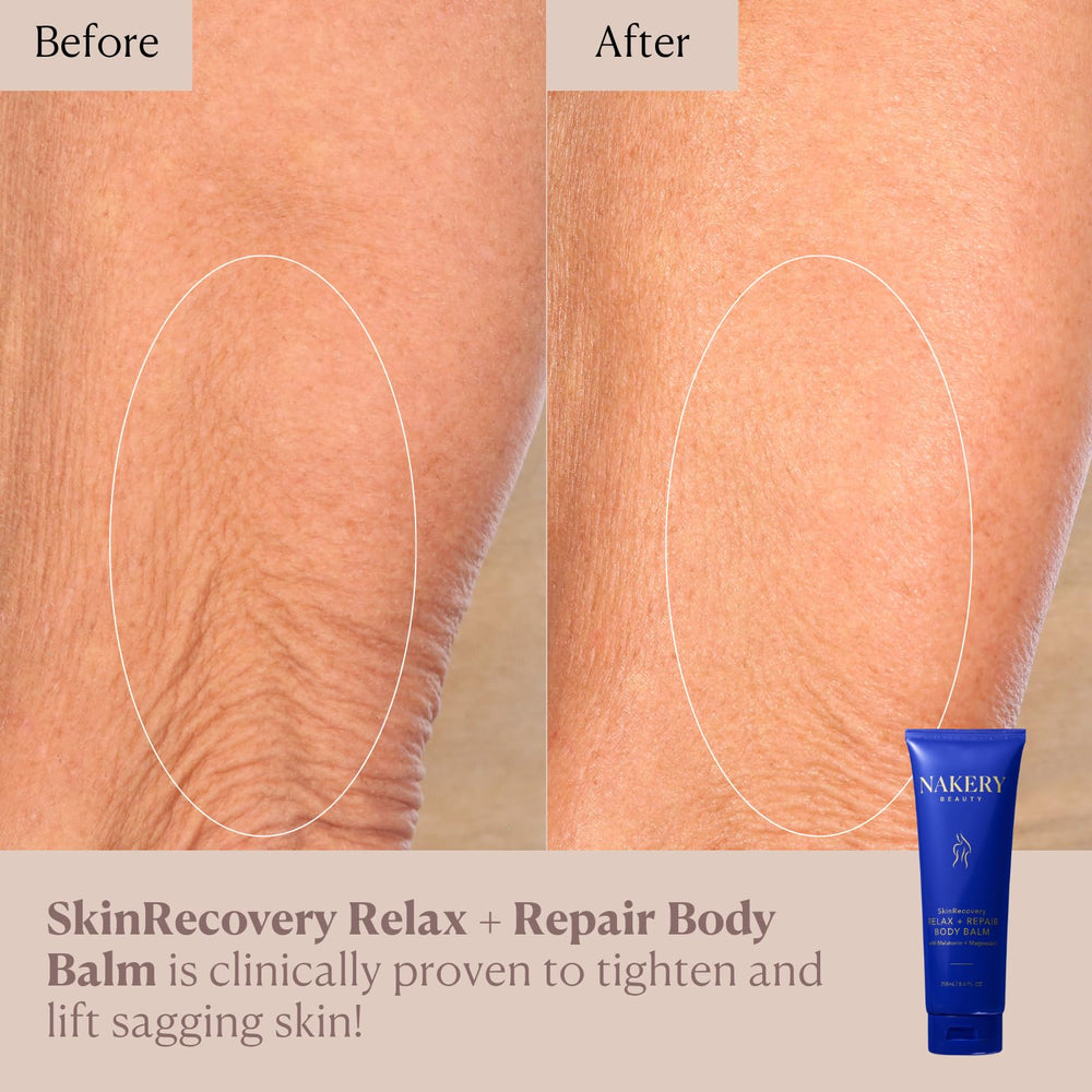 Nakery SkinRecovery: hidratación profunda para piel seca y áspera.