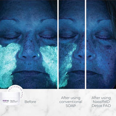 NassifMD Detox Pads: textura suave para un tacto sedoso