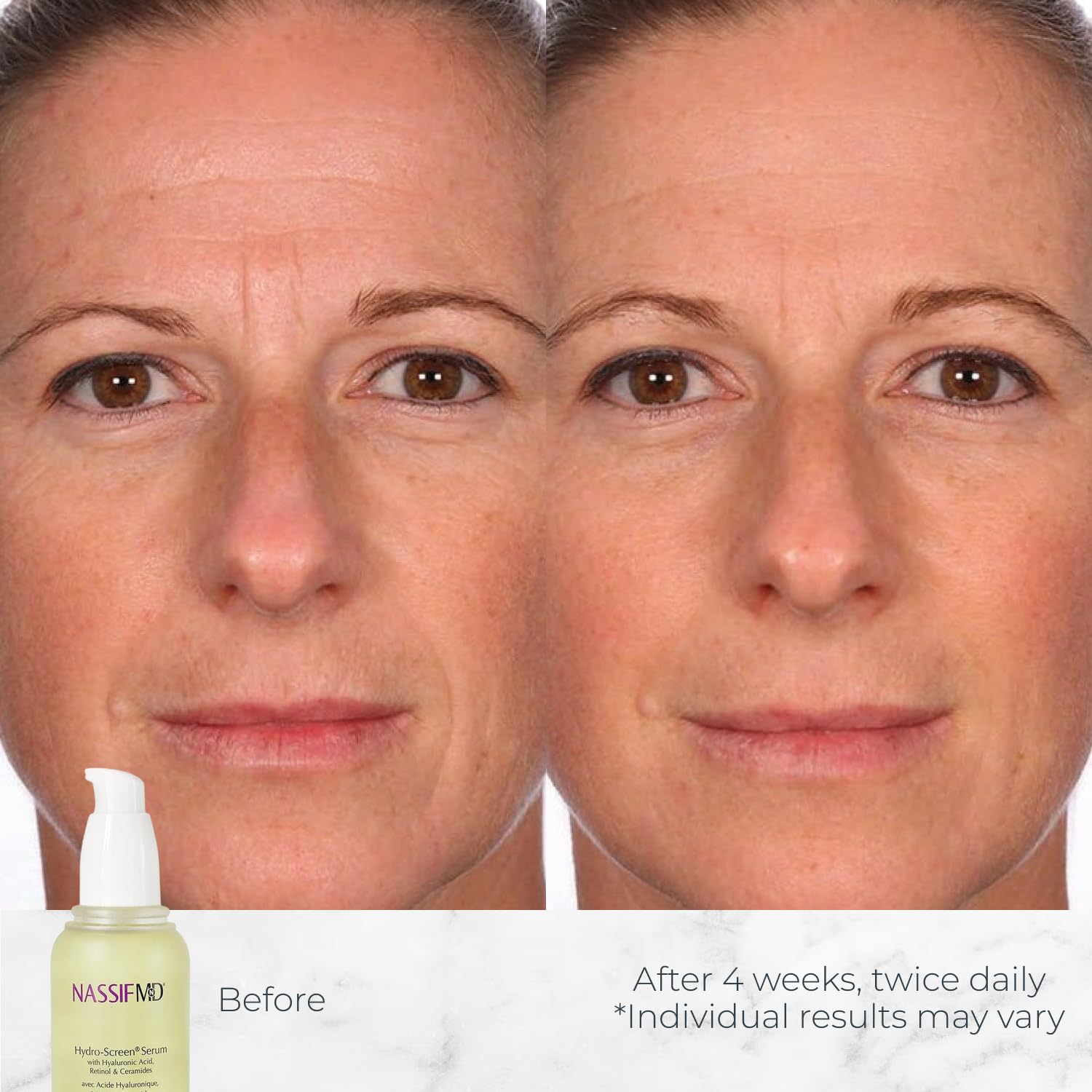 NassifMD Hydro-Screen Serum, aplicación matutina para piel luminosa.