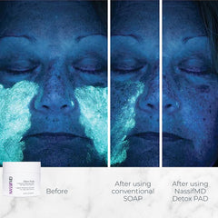 NassifMD toallitas exfoliantes detox, textura suave para piel sensible