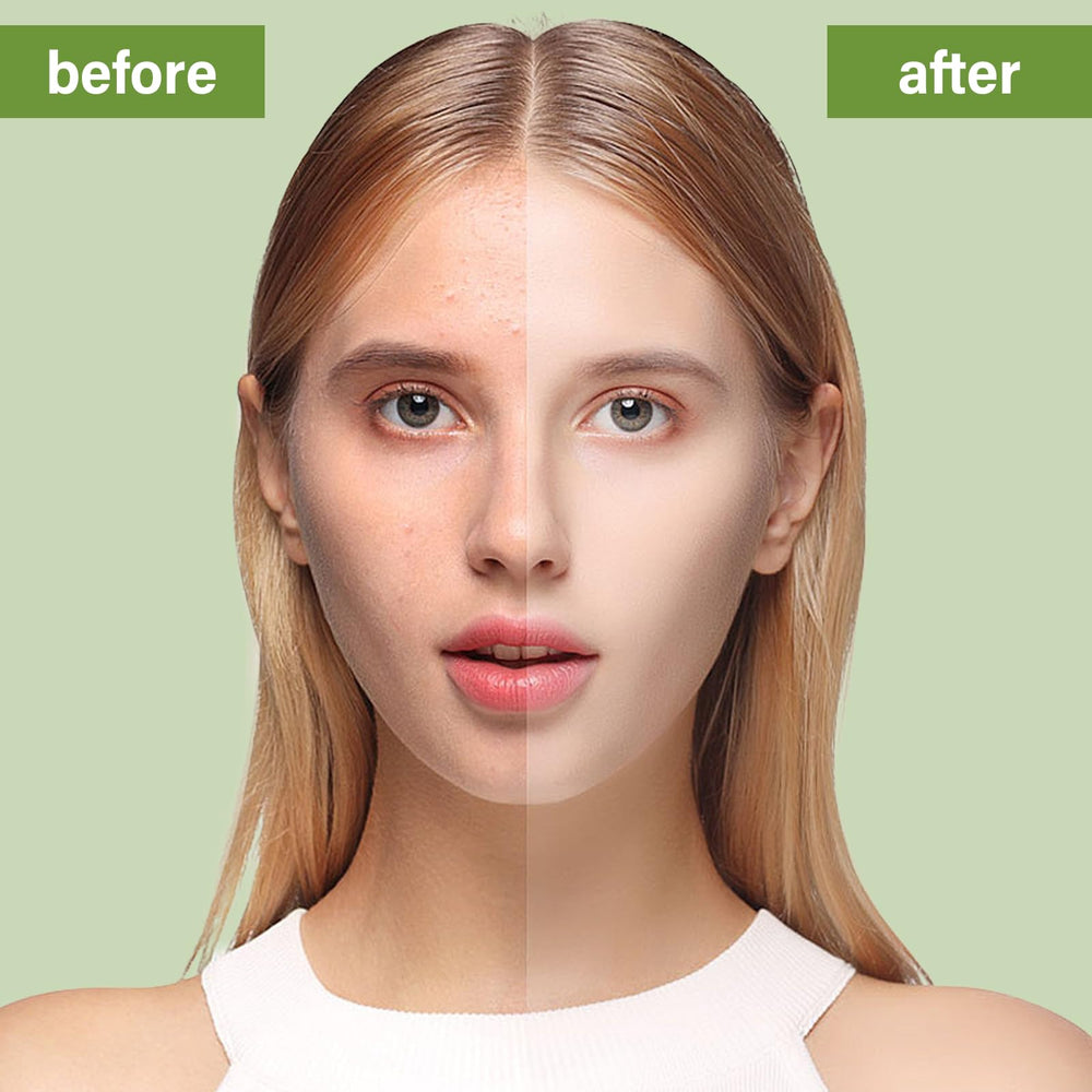 Natura Derm Jabon Facial de árbol de té para piel grasa y refrescar.