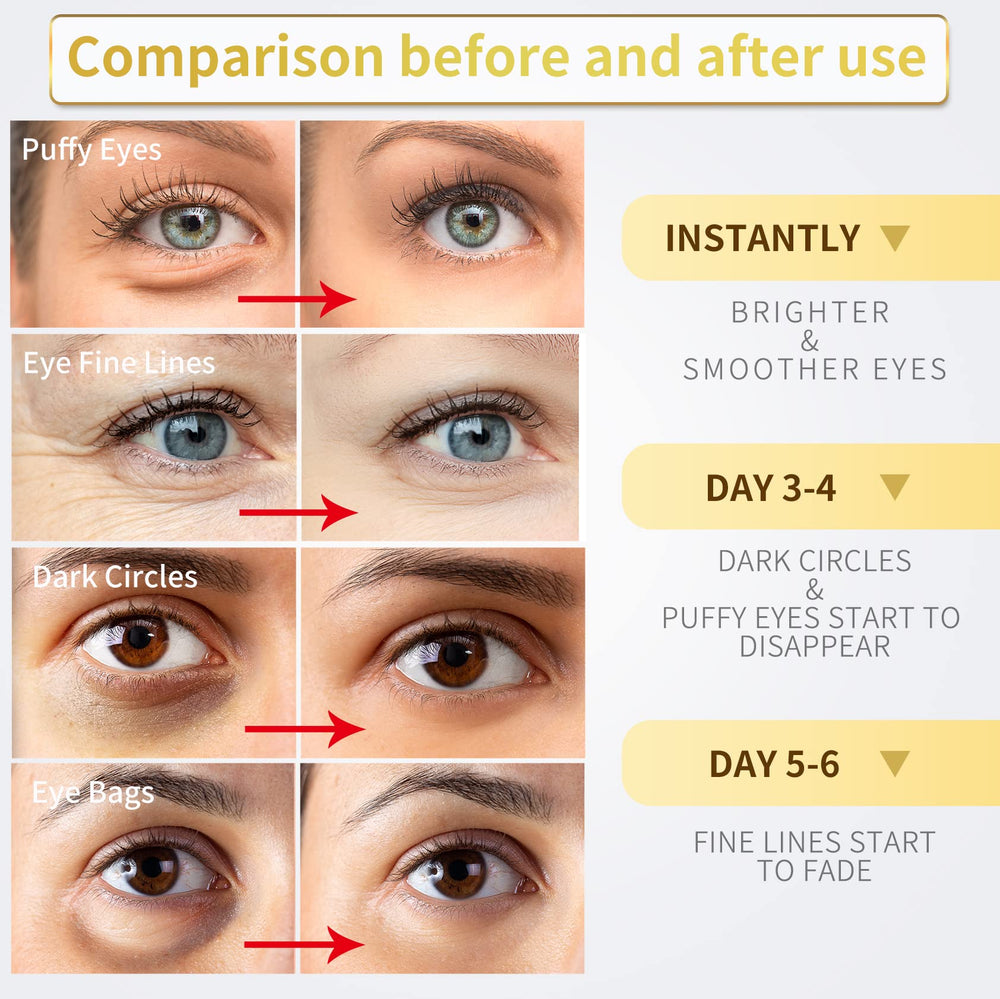 NAZANO parches ojos 24k: fórmula con colágeno y hialurónico para piel suave