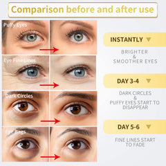 NAZANO parches ojos 24k: fórmula con colágeno y hialurónico para piel suave