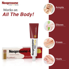 Neoprosone Gel Aplicación Cuerpo: suave para codos y rodillas.