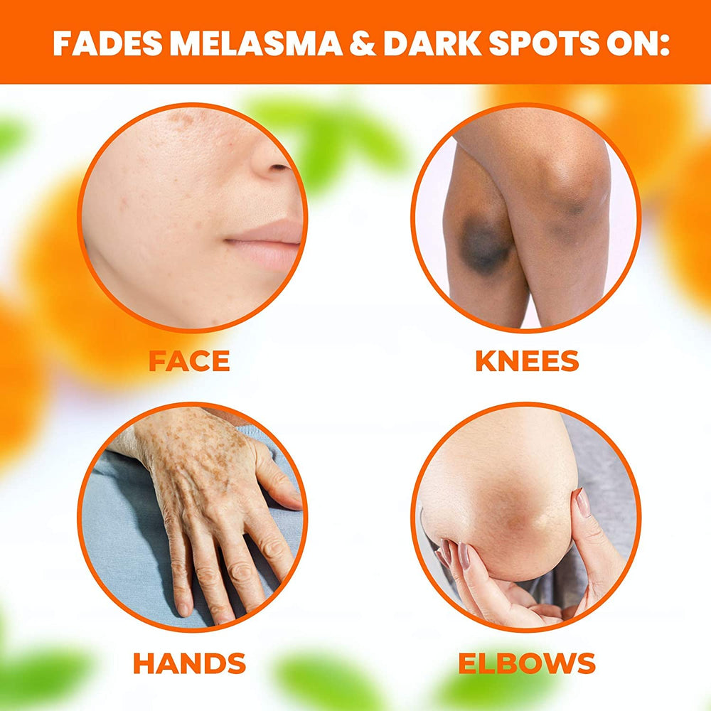 Neoprosone SPF 50 sunscreen paired with serum for daytime protection