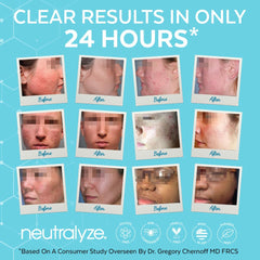 Neutralyze Synergyzer, potenciador de absorción para tratamientos de acné.