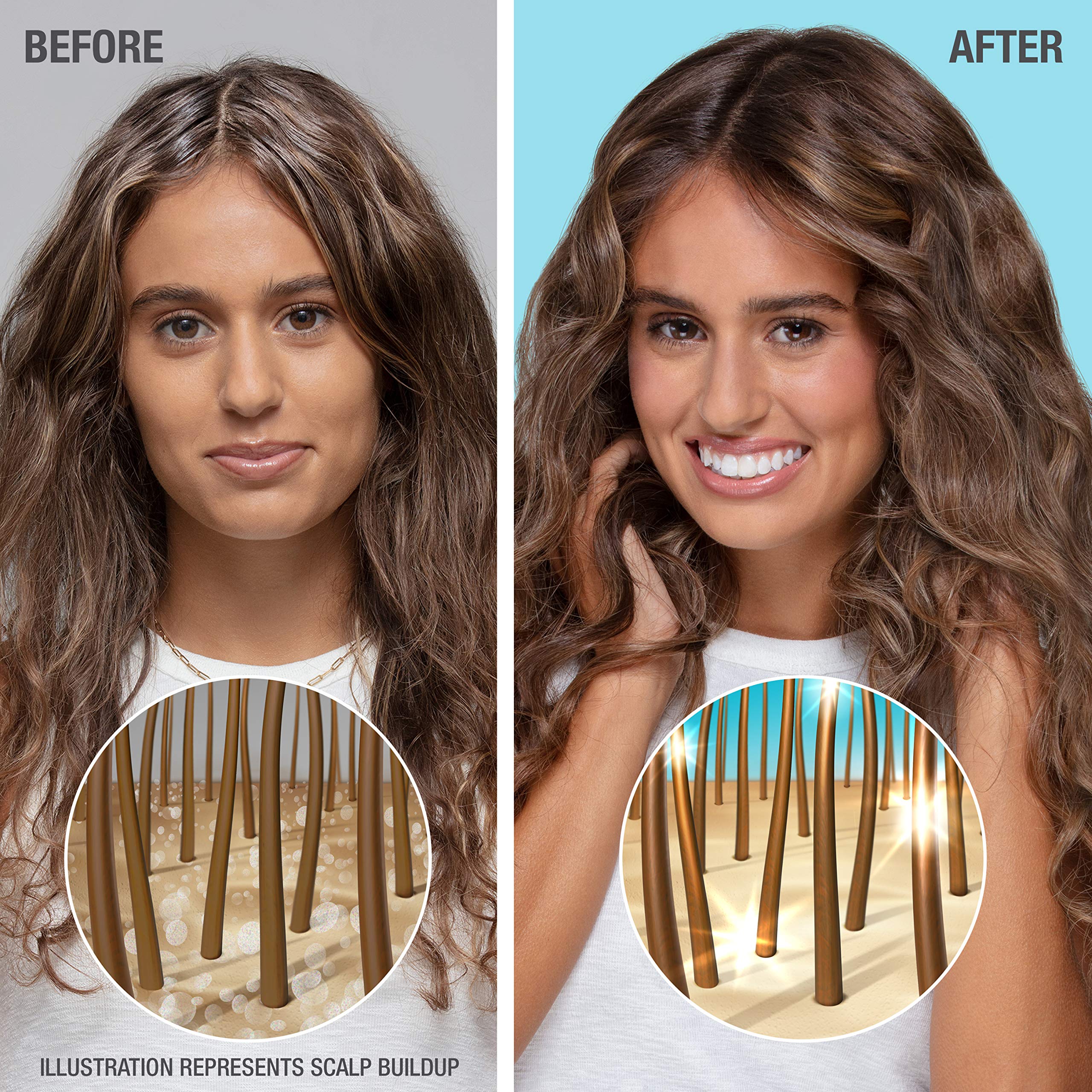 Ácido hialurónico presente en Neutrogena Hydro Boost para retener humedad