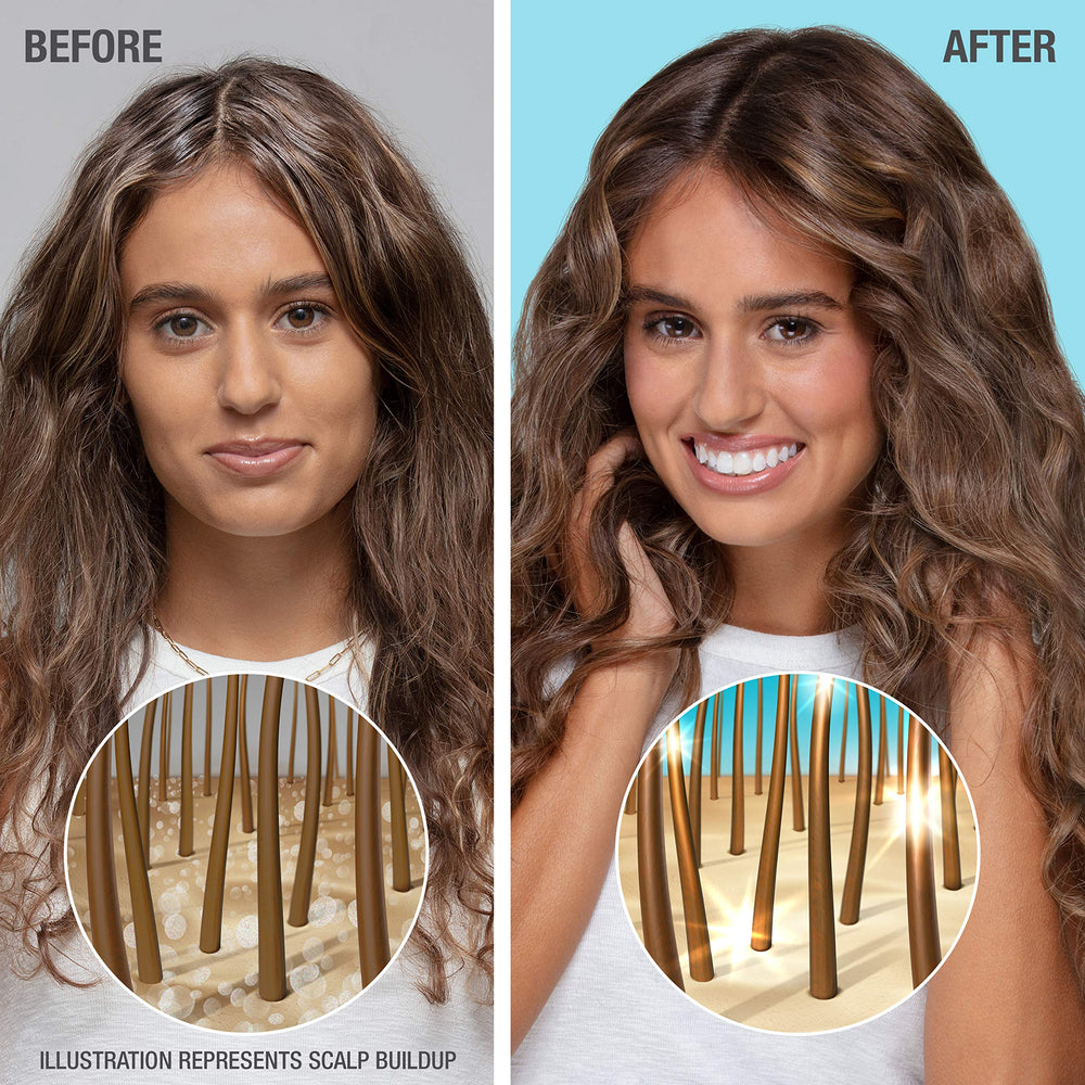 Ácido hialurónico presente en Neutrogena Hydro Boost para retener humedad