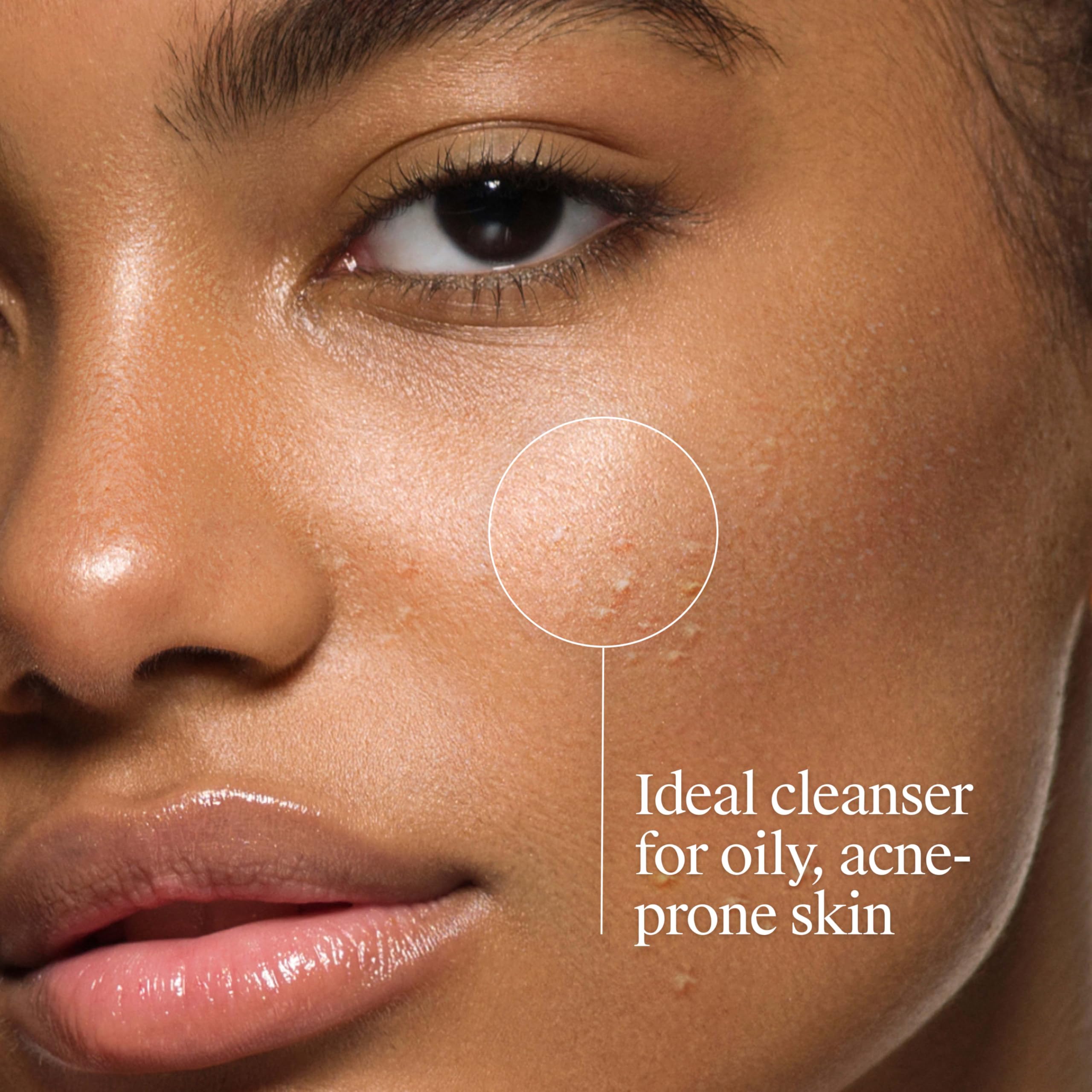 Neutrogena combate poros obstruidos y puntos negros.