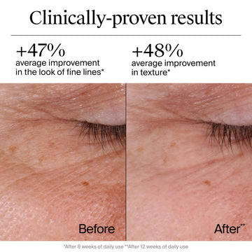 Neutrogena Rapid Wrinkle Repair bottle highlighting hyaluronic acid