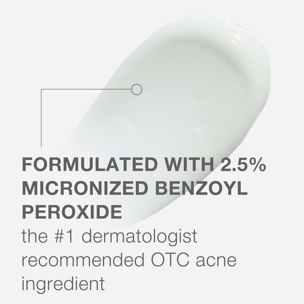 Neutrogena Stubborn Acne AM Treatment tube being applied to skin.
