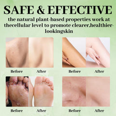 Nichalous Savon Arbre à Thé – Purification des pores et nettoyage en douceur.