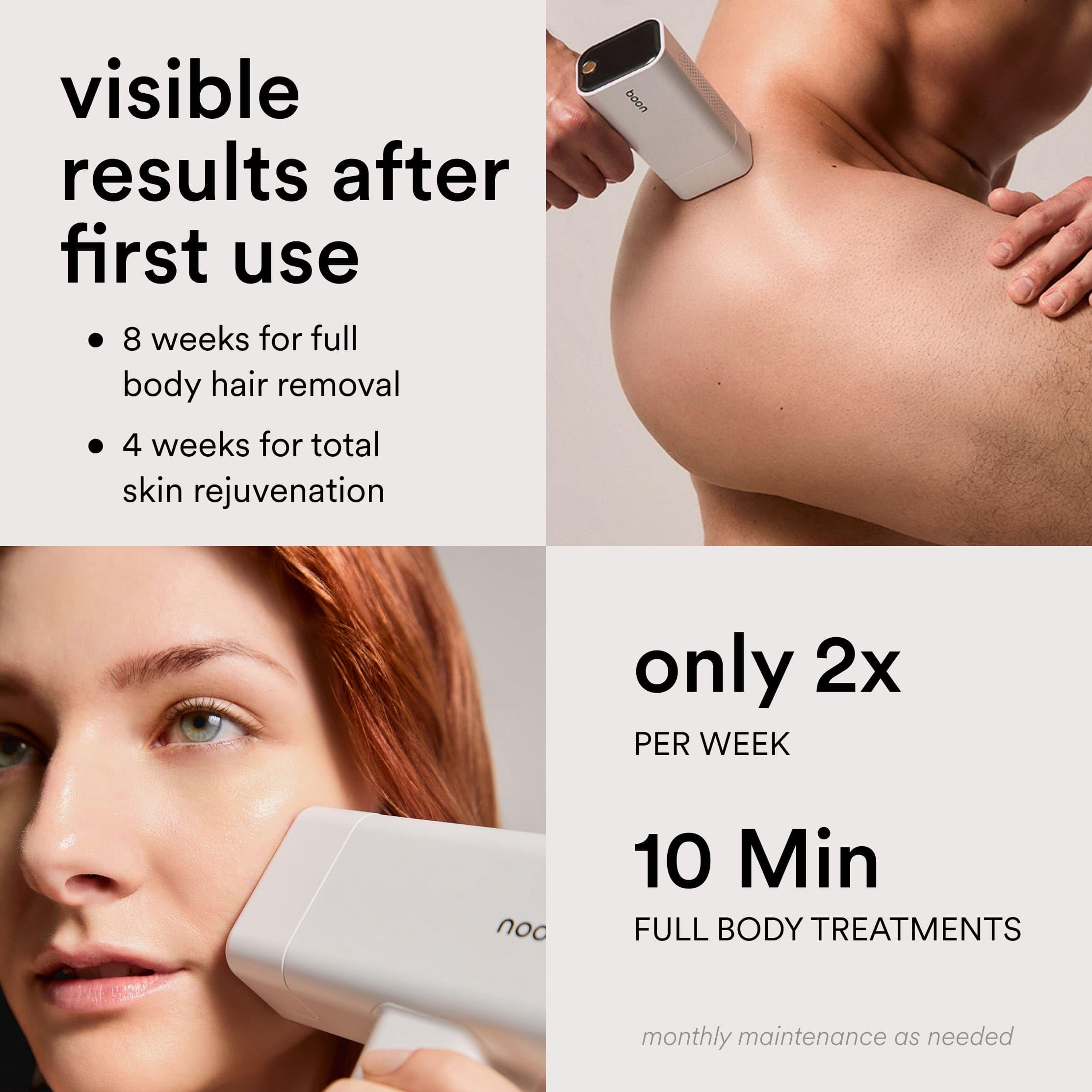 Nood Flasher Pro diseño blanco gloss para uso diario en casa.