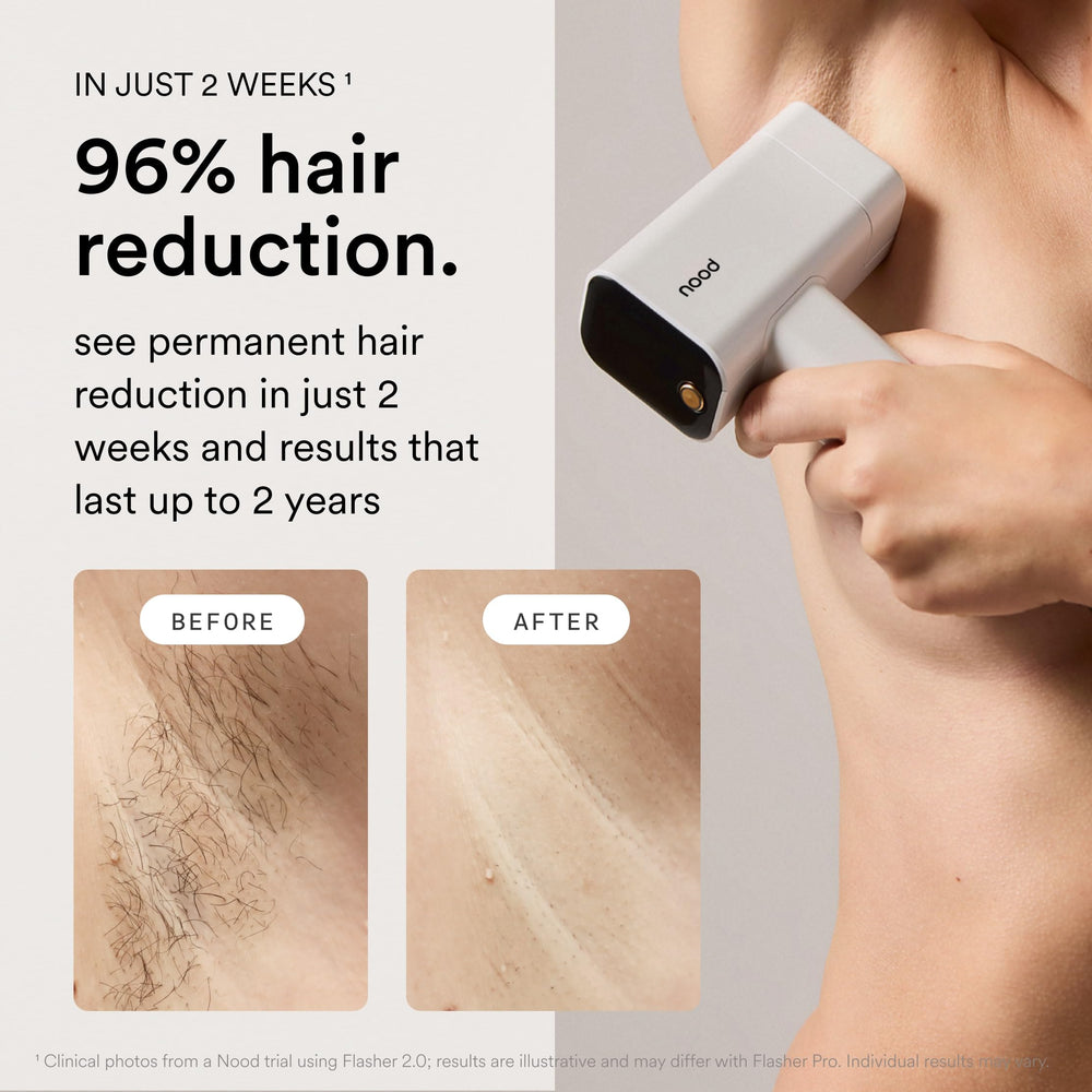 Lente Ageless de Nood facilita tratamiento anti-edad tras cambiar la lente.