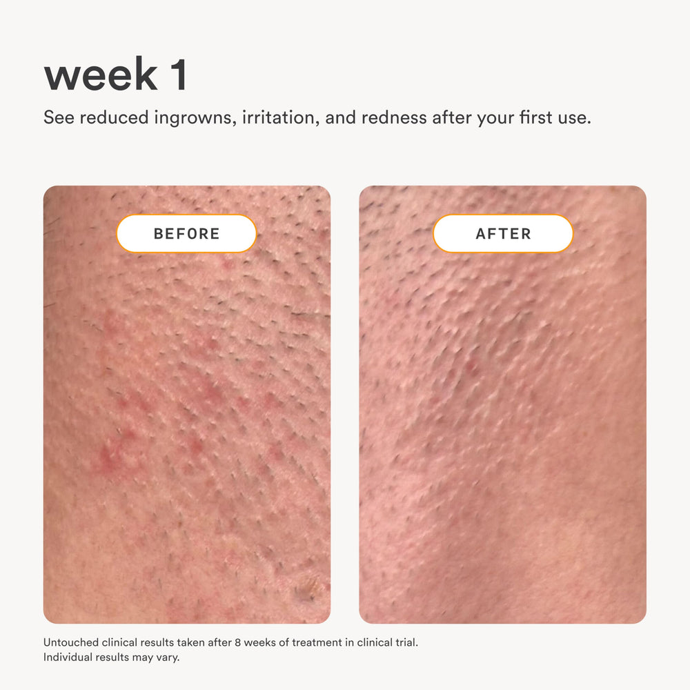 Nood Serum : convient à toutes les zones, peau sensible