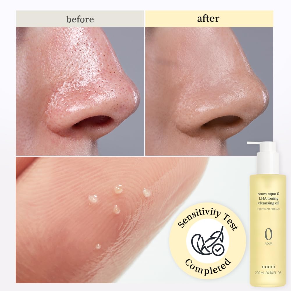 Pores affines et teint plus clair grâce au duo Nooni.